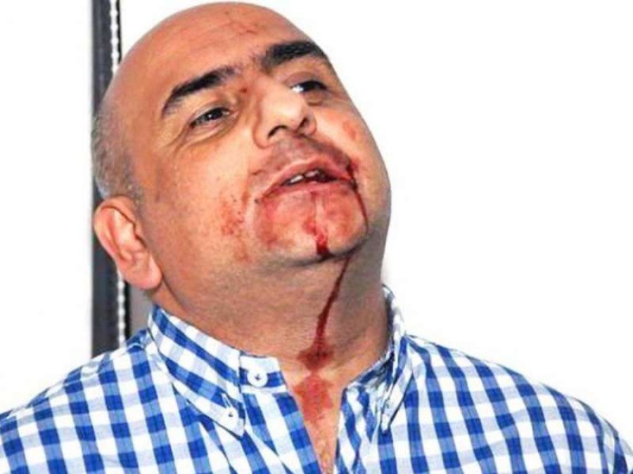 Una pericia determinará si De Narváez dejó incapacitado al periodista platense que trompeó en 2015