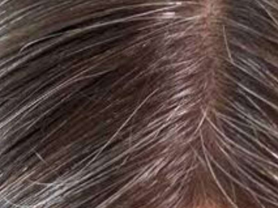 Confirmado: el estrés provoca canas