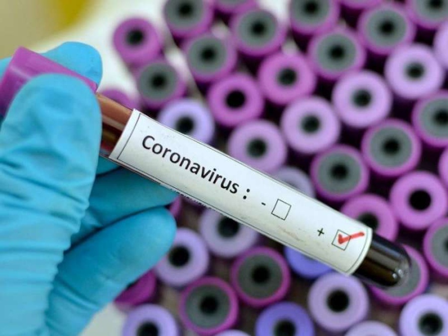 Coronavirus en Argentina: hubo 23 muertes en las últimas 24 horas