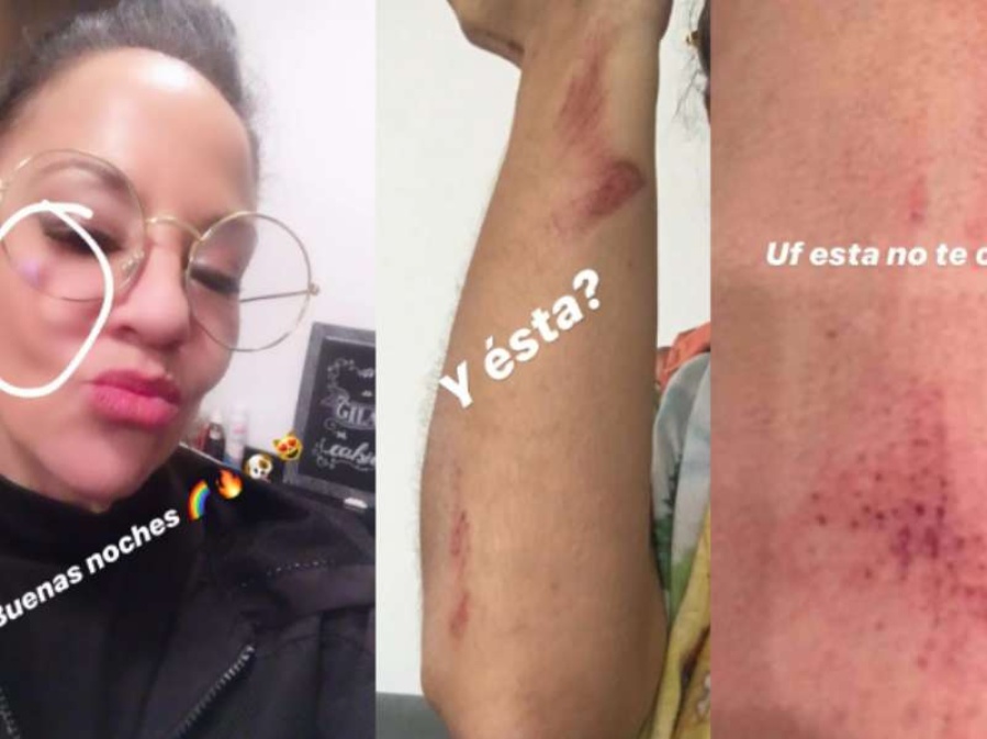 Miss Bolivia denunció a su ex por violencia de género