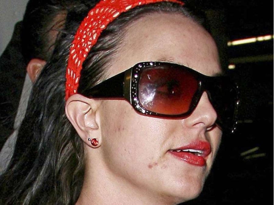  Britney Spears contó que su carrera estuvo en peligro… ¡por el acné! 
