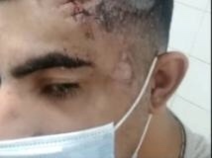 Habló uno de los jóvenes víctima del accidente que protagonizó Carolina Píparo: “Me voló de la moto”