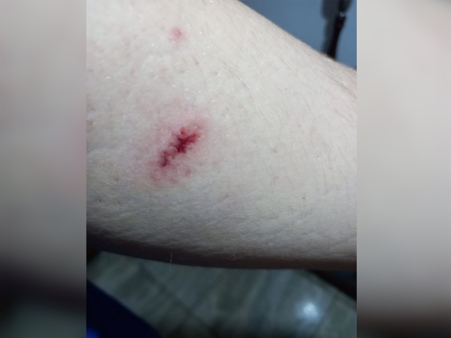 Circulaba con su bicicleta y fue atacado a balazos de aire comprimido en Tolosa