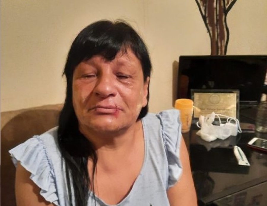 El fiscal recibió a Estela Sánchez, la vecina de Villa Elvira que se cosió la boca: le pidió que deponga su huelga