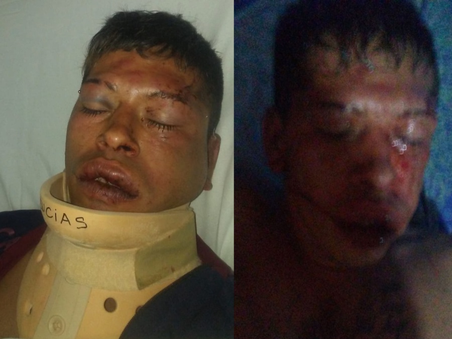 Atacaron salvajemente a un hombre en La Plata y quedó internado inconsciente en el hospital