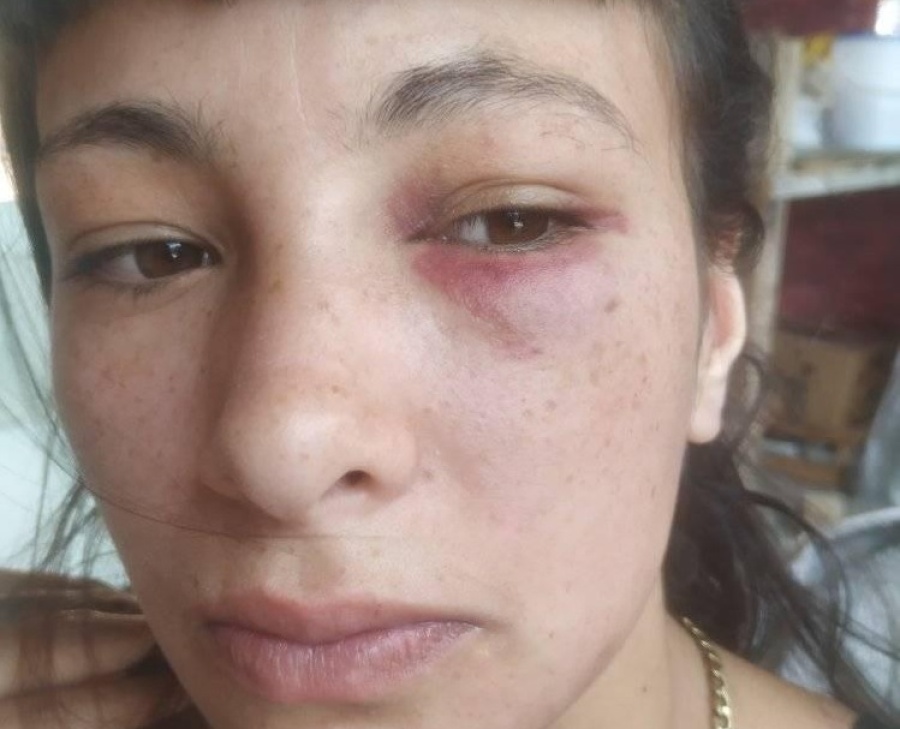 Demencial golpiza a una joven de La Plata: ”Intentó matarme delante de mis propios hijos”