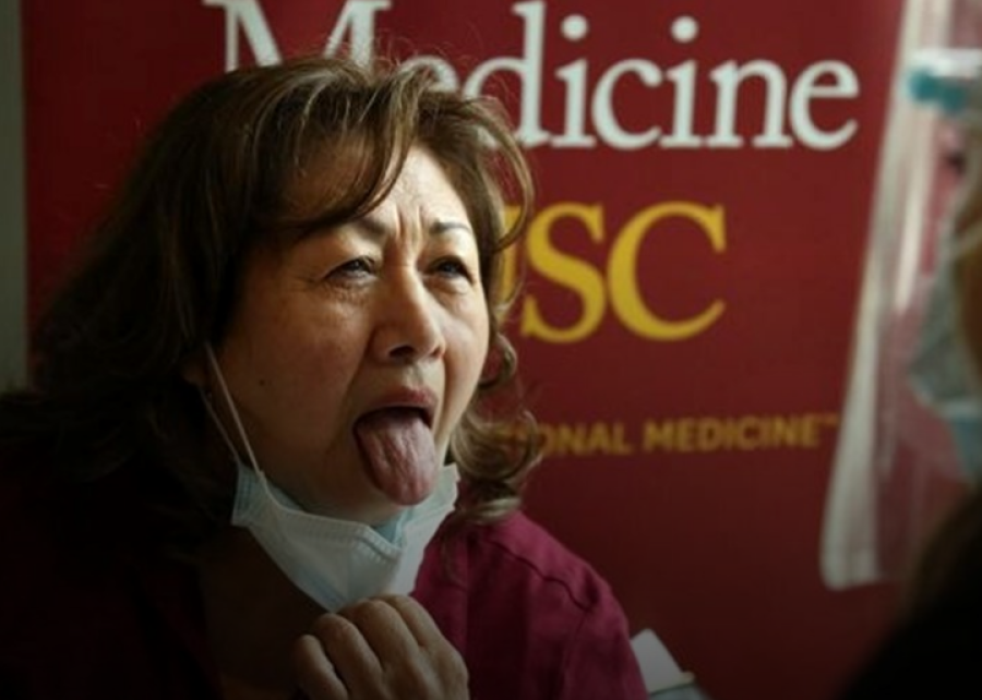 La “lengua covid”: cómo es el nuevo síntoma del coronavirus