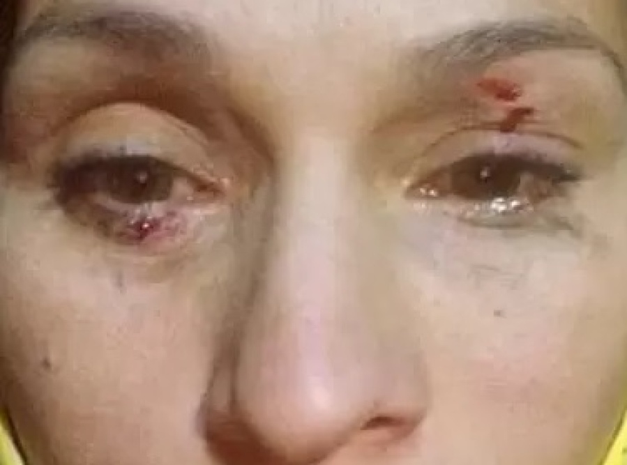 Hace 6 años que intentan usurparle su casa en City Bell y resignada, decide mudarse: “Me golpearon delante de mis hijos”