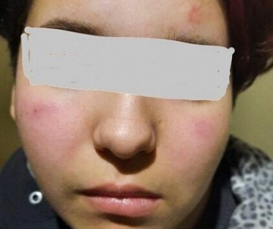 Una patota casi mata a una joven en el centro de Berisso: ya había sido amenazada