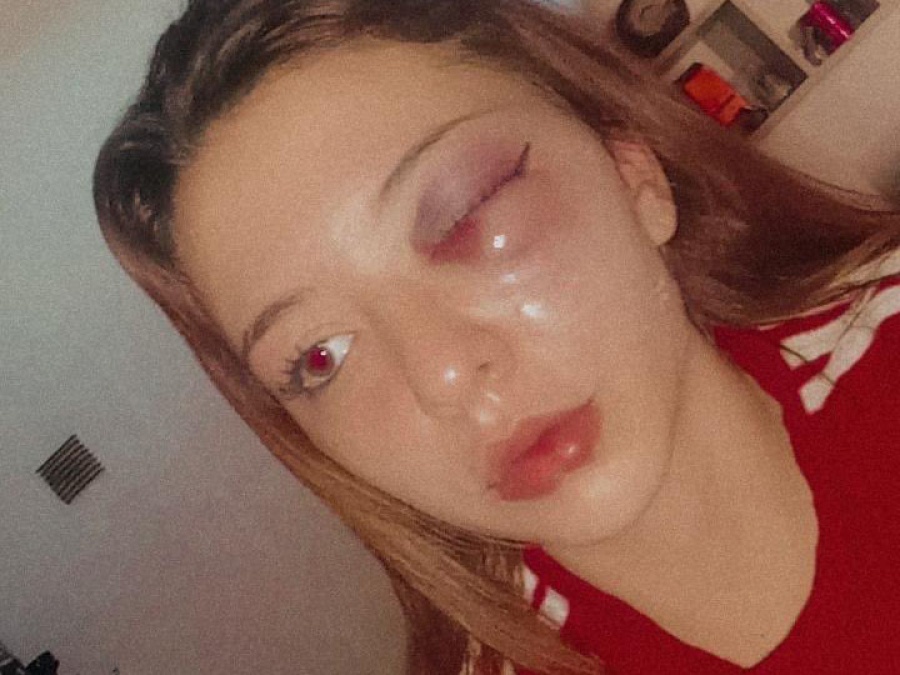 La golpearon hasta desfigurarla en La Plata para robarle una mochila