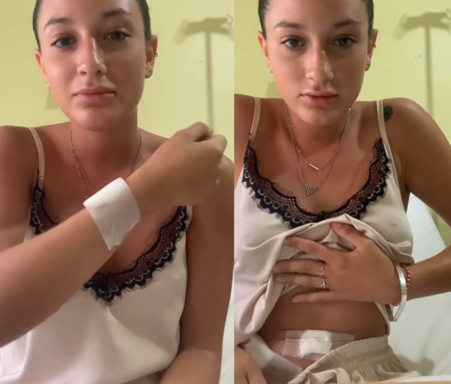 ”Acá estoy, en el hospital”: Operaron a una joven de La Plata por usar la copa menstrual