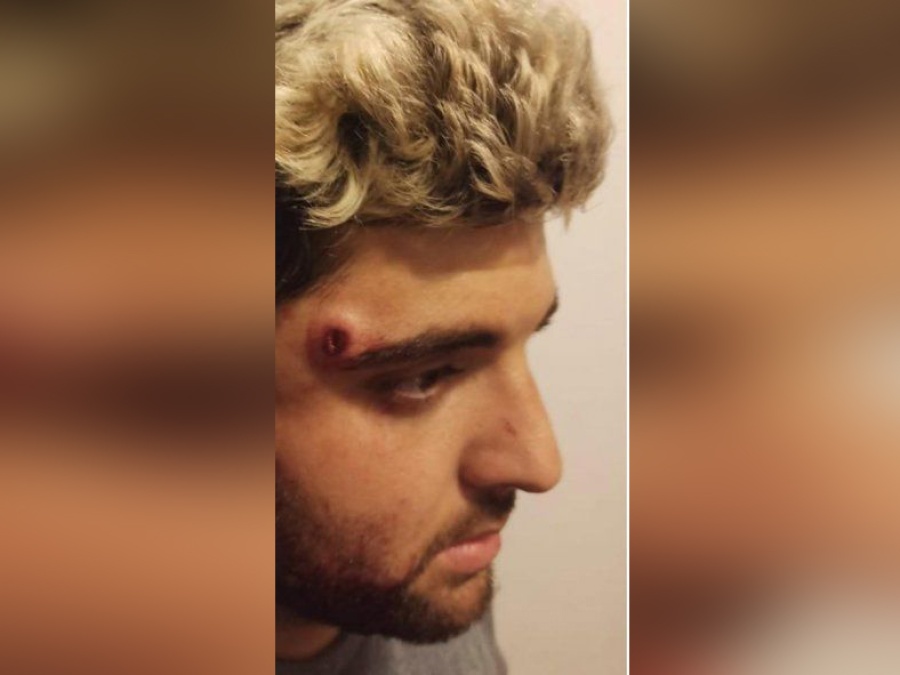 Aprehendieron a varios sospechosos por el caso del rugbier baleado en la cabeza por motochorros en La Plata