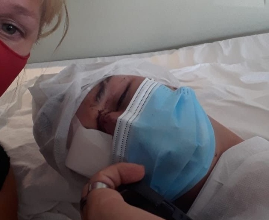 Tiene 18 años y perdió un ojo por la paliza que le propinaron 3 compañeros de trabajo en La Plata