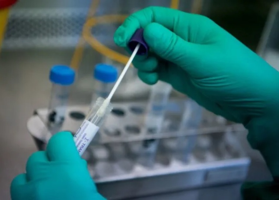 Cómo saber cuando sos caso sospechoso de COVID-19