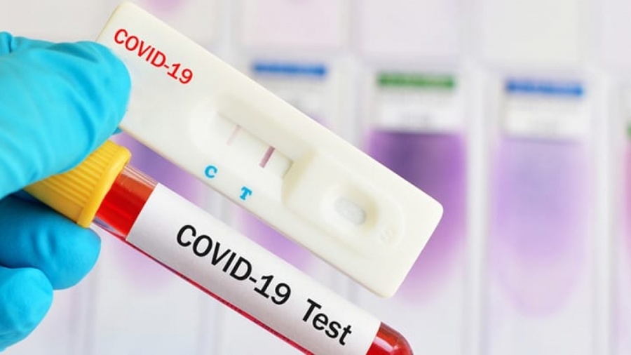 Un test de sangre detectaría qué pacientes con COVID-19 tendrían complicaciones