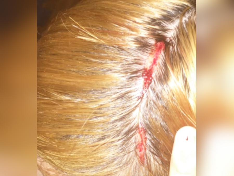 Parte de las lesiones de la víctima