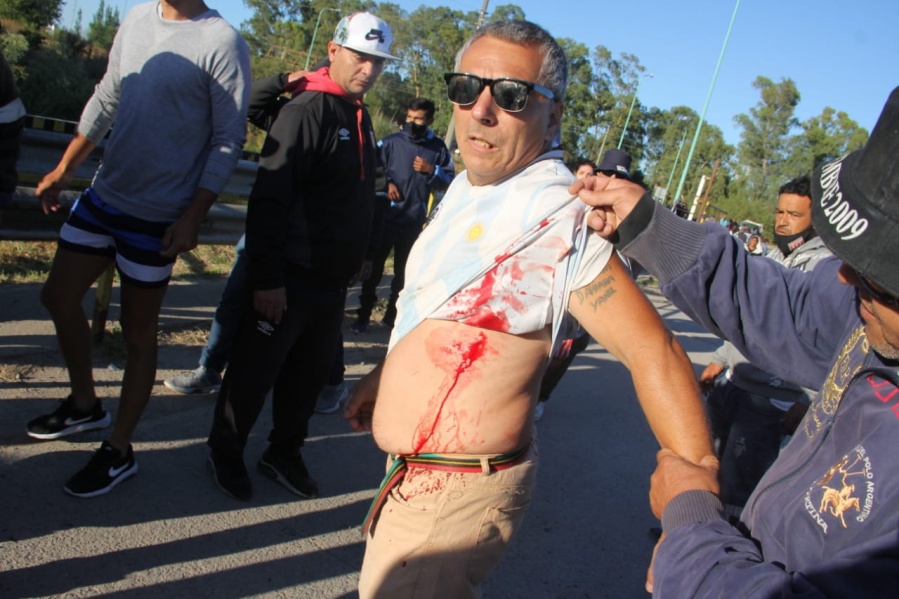 Habló el trabajador de la UOCRA apuñalado en Ensenada: ”El que se paseaba por los canales fue el que me quiso matar”